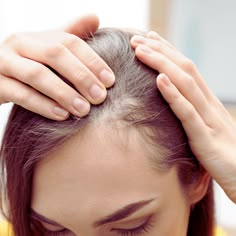 Thinning Hair in Your 30s and 40s: What’s Actually Causing It Thinning Hair in Your 30s and 40s: What’s Actually Causing It